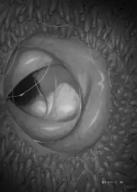 [Hermit9 (Various)] Anal Vore Goudou [Digital]